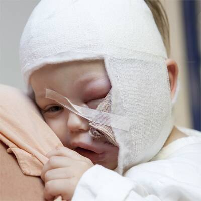 Benet (2) von Hund gebissen