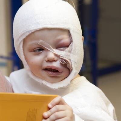 Benet (2) von Hund gebissen