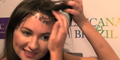 Nach Horror-Crash Gesicht entstellt!