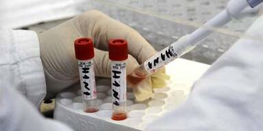 impfstoff_schweinegrippe