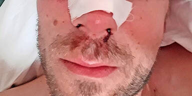 Streit um Eintritt in Klub: Austro-Urlauber verpr&uuml;gelt