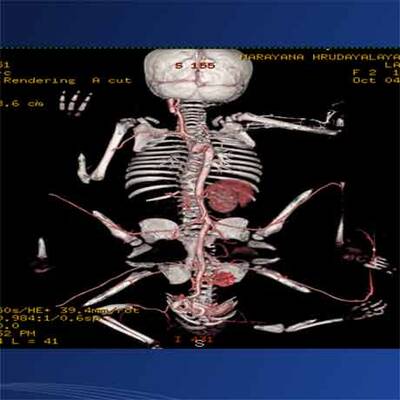 CT der kleinen Lakshmi