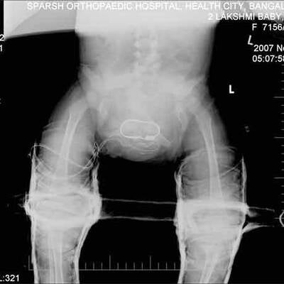 CT der kleinen Lakshmi