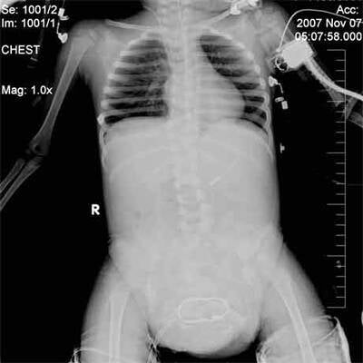CT der kleinen Lakshmi