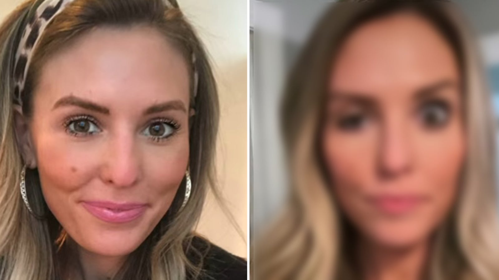 Influencerin Whitney Buha zeigt Mega-Botox-Fail - stars24