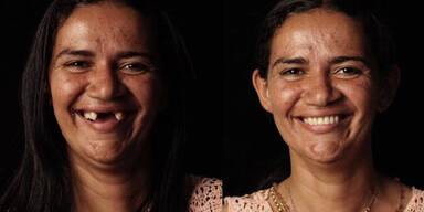 Dieser Zahnarzt schenkt armen Menschen ein neues L&auml;cheln