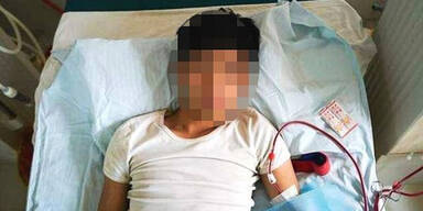 Niere f&uuml;r iPhone verkauft: Mann (25) jetzt Pflegefall