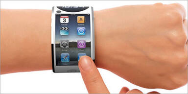 Apple hat Probleme mit der iWatch