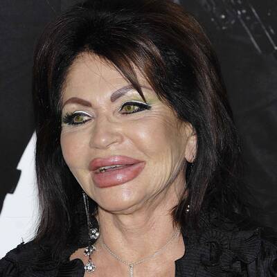 Wer hat Hollywoods schlimmste OP-Fratze?