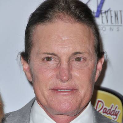 Wer hat Hollywoods schlimmste OP-Fratze?