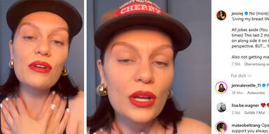 Jessie J