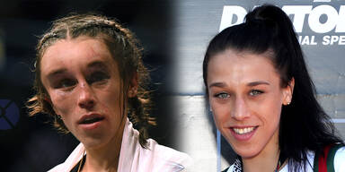 So brutal ist ein Frauen-Kampf in der UFC