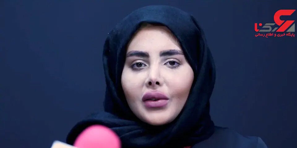 ''Zombie-Angelina-Jolie'' zeigt ihr wahres Gesicht