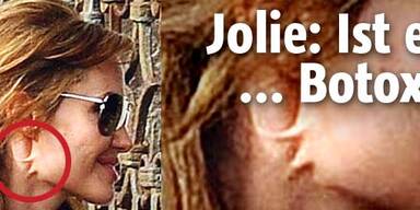Botox-Alarm bei Miss Jolie