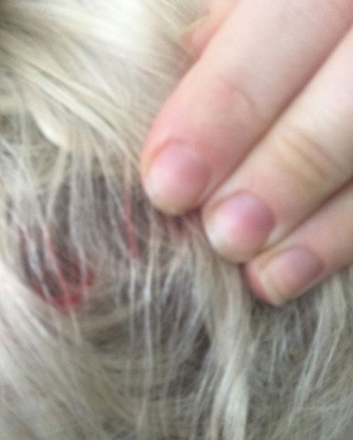 Miley Cyrus: Von der Katze zerkratzt