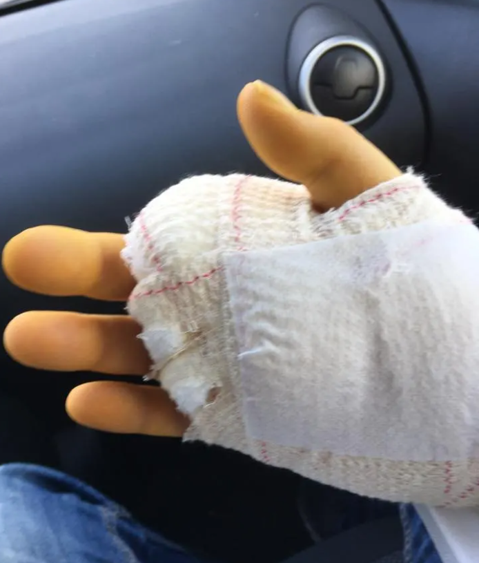 33-jähriger Mann stirbt nach Katzenbiss