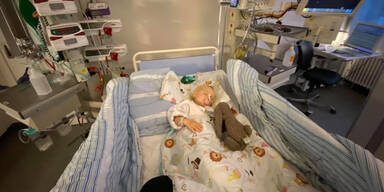 L&ouml;cher in den Organen: M&auml;dchen (2) schluckt 21 Magnet-Kugeln