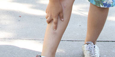 kind-verletzung_fally