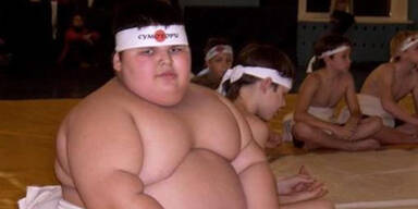 Einst "dickstes Kind der Welt" ist mit 21 Jahren gestorben