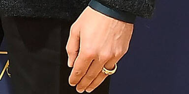 Geheim-Verlobung? Kaulitz trägt verdächtigen Ring