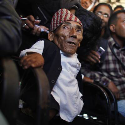 Das ist der kleinste Mensch der Welt