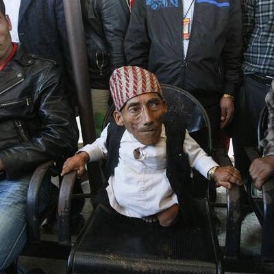 Das ist der kleinste Mensch der Welt