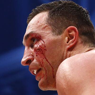 Wladimir Klitschko blutig entthront