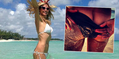 Heidi Klum zeigt ihren Sonnenbrand