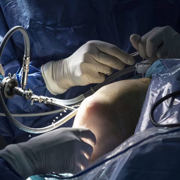 Wartezeit-Verdoppelung: 87 Wochen Wartezeit auf Knie-OP | Peter Binder