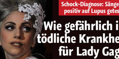 Lady Gaga positiv auf Lupus getestet