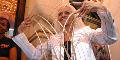 Frau verliert l&auml;ngste Fingern&auml;gel der Welt bei Auto-Unfall