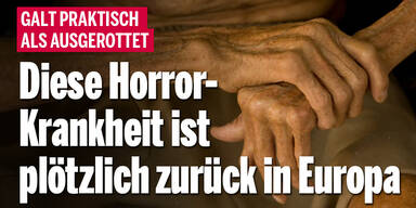 Diese Horror-Krankheit ist plötzlich zurück in Europa