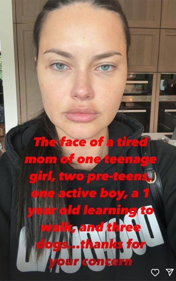 Adriana Lima über ihr Gesicht: 