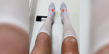 lindsay vonn knie.png