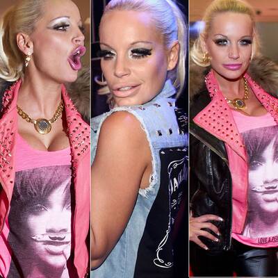 Gina-Lisa Lohfink mit Botox-Überdosis