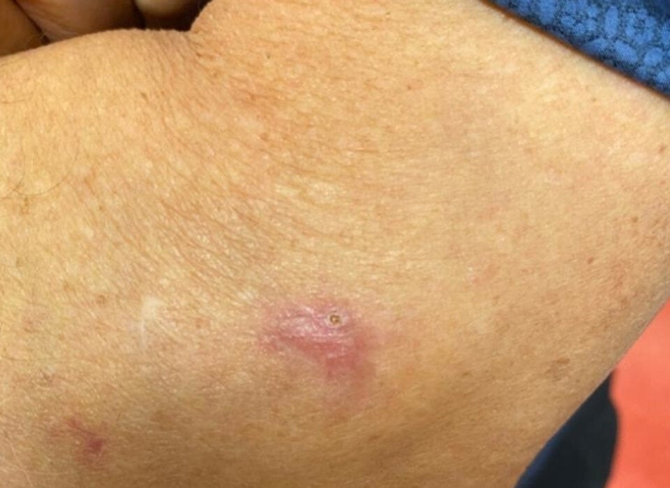 Lugner: Nach Krebs-OP soll er sich schonen