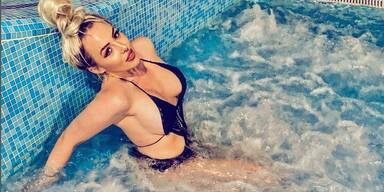 Lugners ''Wildsau'' mit Botox-Beichte