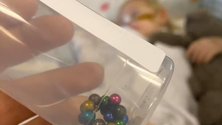 Löcher in den Organen: Mädchen (2) schluckt 21 Magnet-Kugeln