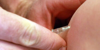 Masern in &Ouml;sterreich auf dem Vormarsch