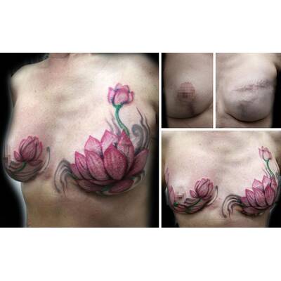 Tattookünstlerin verdeckt Narben von Gewaltopfern