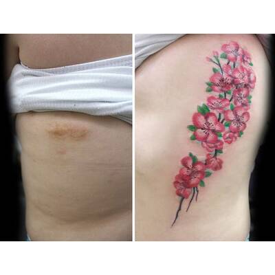 Tattookünstlerin verdeckt Narben von Gewaltopfern