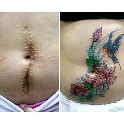 Tattookünstlerin verdeckt Narben von Gewaltopfern