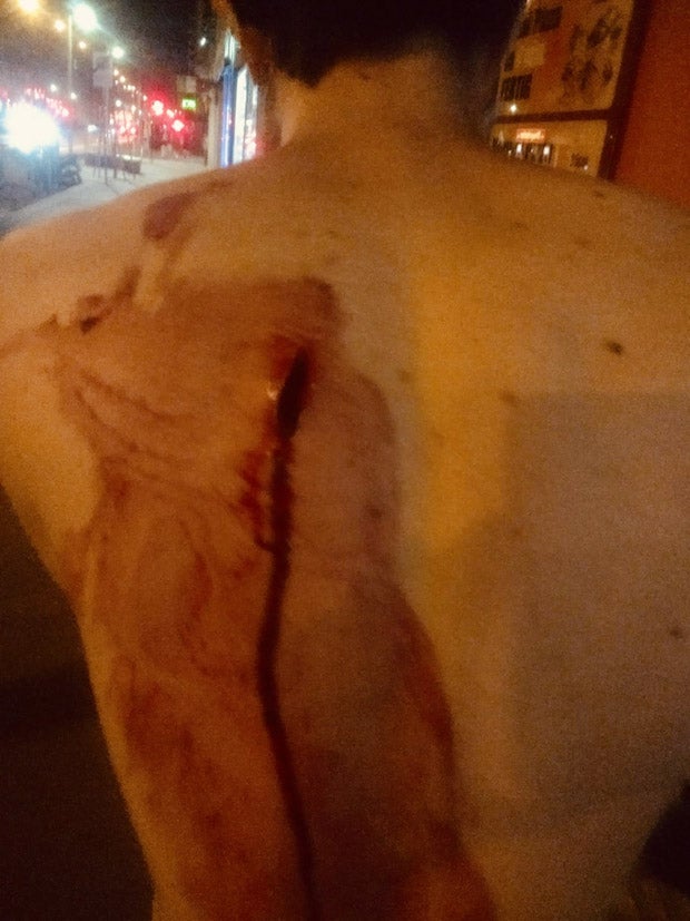 28-Jährigen in Rücken gestochen: Jetzt spricht das Opfer