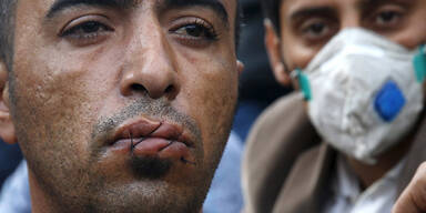 Aus Protest: Flüchtlinge nähen sich Mund zu 