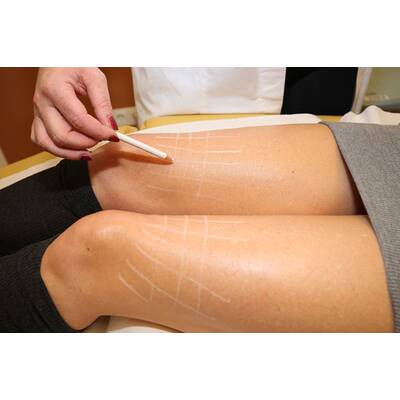 Mausi beim Beauty-Doc