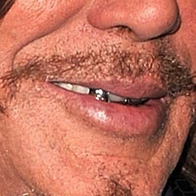 Mickey Rourke: Star mit Zahnproblem?