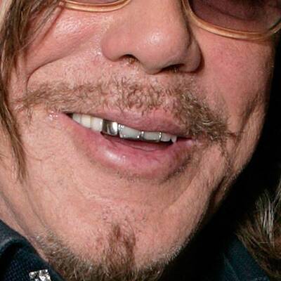 Mickey Rourke: Star mit Zahnproblem?