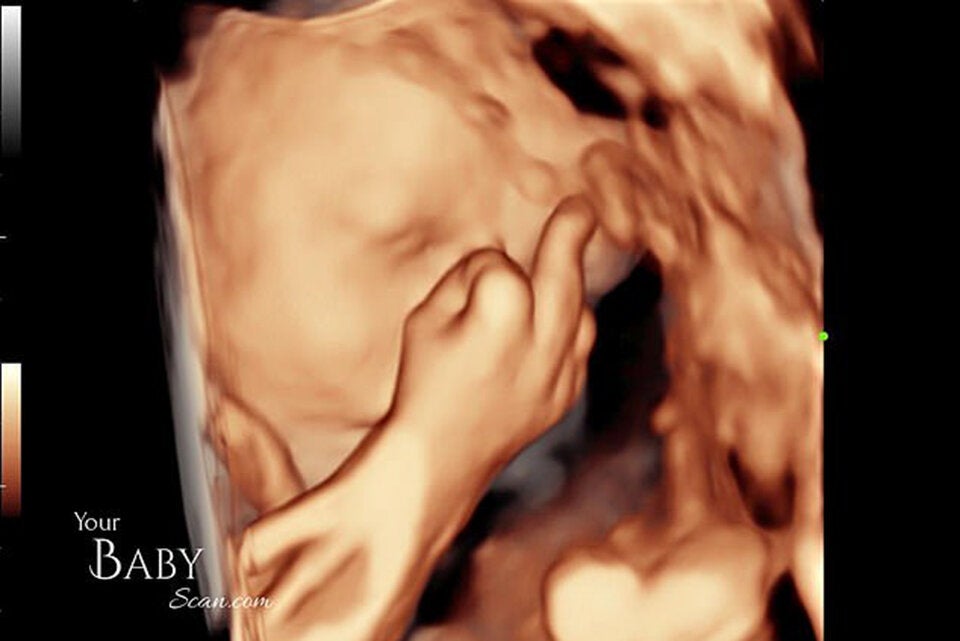 Ungeborenes Baby zeigt Eltern im Ultraschall Mittelfinger