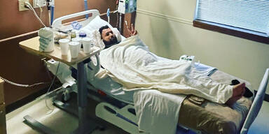 Gabe Lustman (30) wurde von einer Giftspinne gebissen