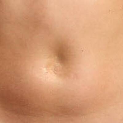 Hat Karolina Kurkova keinen Nabel?